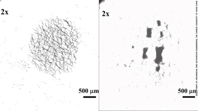 Nano-swarm robots developed by scientists at the Hong Kong University