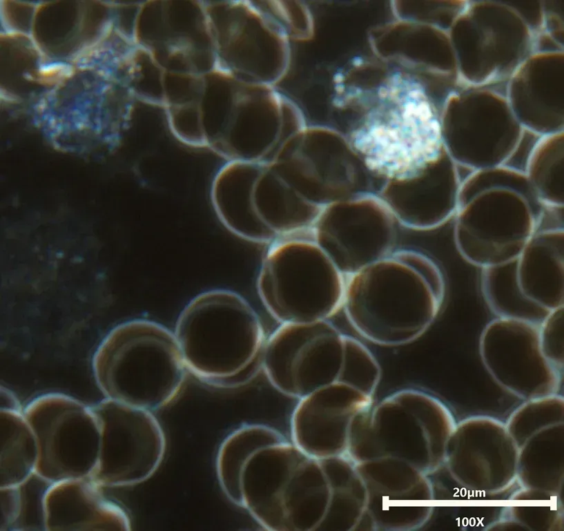 Artificial white blood cells detected