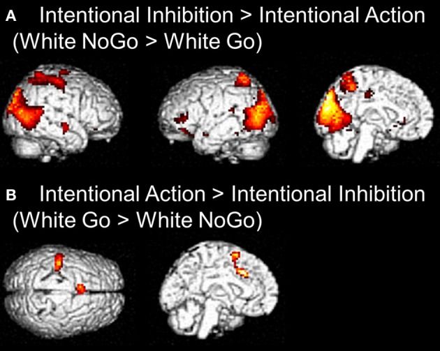 Inhibited Intentionality: On Possible Self-Understanding in Cases of Weak Agency